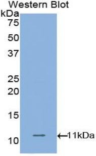 CDH1 / E Cadherin Antibody - Western blot of recombinant CDH1 / E Cadherin.  This image was taken for the unconjugated form of this product. Other forms have not been tested.