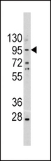 CDH1 / E Cadherin Antibody - Western blot of CDH1 Antibody in A375 cell line lysates (35 ug/lane). CDH1 (arrow) was detected using the purified antibody.