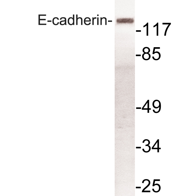 CDH1 / E Cadherin Antibody - Western blot of E-cadherin (R868) pAb in extracts from HeLa cells.