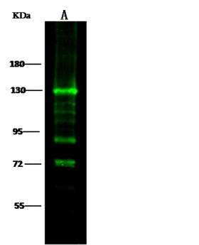 CDH1 / E Cadherin Antibody - Anti-CDH1 rabbit monoclonal antibody at 1:500 dilution. Lane A: A431 Whole Cell Lysate. Lysates/proteins at 30 ug per lane. Secondary: Goat Anti-Rabbit IgG H&L (Dylight 800) at 1/10000 dilution. Developed using the Odyssey technique. Performed under reducing conditions. Predicted band size: 97 kDa. Observed band size: 93 kDa.