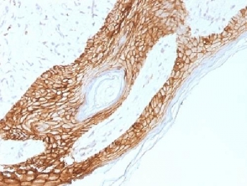 CDH1 / E Cadherin Antibody - IHC testing of FFPE human skin with E-Cadherin antibody (clone 4A2). Required HIER: boil tissue sections in 10mM citrate buffer, pH 6.0, for 10-20 min.