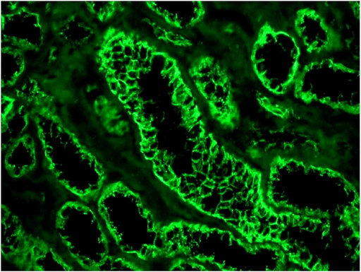 CDH1 / E Cadherin Antibody - E-cadherin staining of epithelial cells in the different types of tubular structures in human kidney using CDH1 / E Cadherin (5H9).