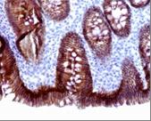 CDH1 / E Cadherin Antibody - Immunohistochemistry on paraffin-embedded sections of small intestine.