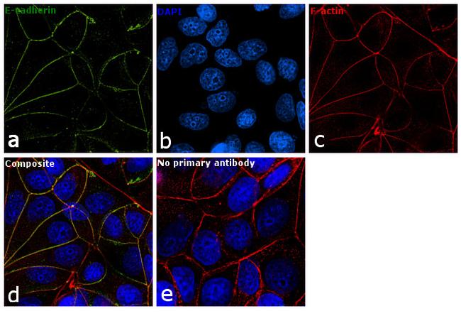 CDH1 / E Cadherin Antibody - E-cadherin Antibody in Immunofluorescence (IF)