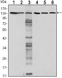 CDH1 / E Cadherin Antibody - Western blot using CDH1 mouse monoclonal antibody against LNCAP (1),A431 (2), DU145 (3), PC-3 (4), PC-12 (5) and T47D(6) cell lysate.