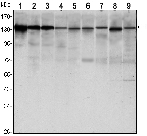 CDH1 / E Cadherin Antibody - Western blot using CDH1 mouse monoclonal antibody against LNCAP (1),A431 (2), DU145 (3), PC-3 (4), MCF-7 (5), PC-12 (6), NIH/3T3 (7), C6 (8) and COS7 (9) cell lysate.