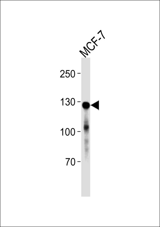 CDH1 / E Cadherin Antibody - CDH1 Antibody western blot of MCF-7 cell line lysates (35 ug/lane). The CDH1 antibody detected the CDH1 protein (arrow).
