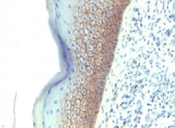 CDH1 / E Cadherin Antibody - Formalin-fixed, paraffin-embedded human skin stained with E-Cadherin antibody (CDH1/1525).