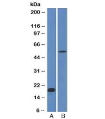 CDH1 / E Cadherin Antibody - Western blot analysis A) partial recombinant protein B) human stomach lysate using E-Cadherin antibody (CDH1/1525). Expected molecular weight: 135 kDa (precursor), 80-120 kDa (mature, depending on gylcosylation level).