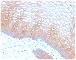 CDH1 / E Cadherin Antibody - Formalin-fixed, paraffin-embedded human Cervix stained with E-Cadherin Rabbit Recombinant Monoclonal Antibody (CDH1/2208R).