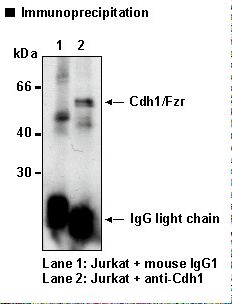 CDH1 / E Cadherin Antibody