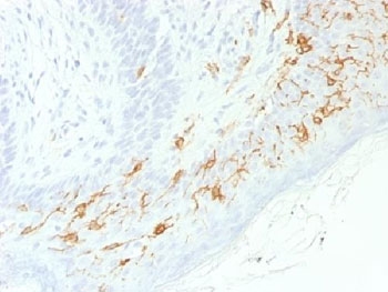 CDH1 / E Cadherin Antibody - IHC testing of FFPE human skin with recombinant CD1a antibody (clone C1A/1506R). Required HIER: boil tissue sections in 10mM Citrate buffer, pH 6, for 10-20 min.