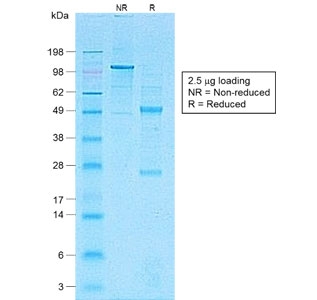 CDH1 / E Cadherin Antibody - SDS-PAGE analysis of purified, BSA-free recombinant CD1a antibody (clone C1A/1506R) as confirmation of integrity and purity.