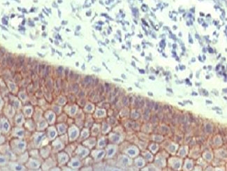 CDH1 / E Cadherin Antibody - IHC testing of FFPE human skin with E-Cadherin antibody at 1ug/ml. HIER: steam sections in pH6 citrate buffer for 20 min.