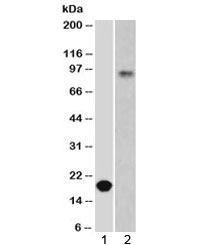 CDH1 / E Cadherin Antibody - Western blot testing of 1) partial recombinant protein and 2) human stomach lysate using E-Cadherin antibody at 0.5ug/ml. Expected molecular weight: 135 kDa (precursor), 80-120 kDa (mature, depending on gylcosylation level).