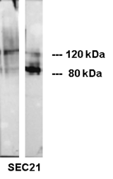 CDH1 / E Cadherin Antibody - Western blot moderate reactivity with the 120 kDa full length protein (left lane) and strong reactivity with the 80 kDa extracellular part (right lane) of E-Cadherin