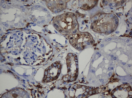 CDH1 / E Cadherin Antibody - IHC of paraffin-embedded Human Kidney tissue using anti-CDH1 mouse monoclonal antibody. (Heat-induced epitope retrieval by 10mM citric buffer, pH6.0, 120°C for 3min).