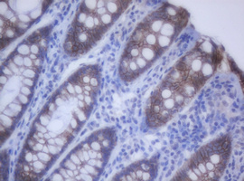 CDH1 / E Cadherin Antibody - IHC of paraffin-embedded Human colon tissue using anti-CDH1 mouse monoclonal antibody.