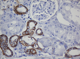 CDH1 / E Cadherin Antibody - IHC of paraffin-embedded Human Kidney tissue using anti-CDH1 mouse monoclonal antibody. (Heat-induced epitope retrieval by 10mM citric buffer, pH6.0, 120°C for 3min).