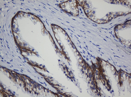 CDH1 / E Cadherin Antibody - IHC of paraffin-embedded Human prostate tissue using anti-CDH1 mouse monoclonal antibody. (Heat-induced epitope retrieval by 10mM citric buffer, pH6.0, 120°C for 3min).