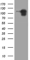 CDH1 / E Cadherin Antibody - HEK293T cells were transfected with the pCMV6-ENTRY control (Left lane) or pCMV6-ENTRY CDH1 (Right lane) cDNA for 48 hrs and lysed. Equivalent amounts of cell lysates (5 ug per lane) were separated by SDS-PAGE and immunoblotted with anti-CDH1.