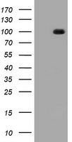 CDH1 / E Cadherin Antibody - HEK293T cells were transfected with the pCMV6-ENTRY control (Left lane) or pCMV6-ENTRY CDH1 (Right lane) cDNA for 48 hrs and lysed. Equivalent amounts of cell lysates (5 ug per lane) were separated by SDS-PAGE and immunoblotted with anti-CDH1.