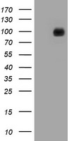 CDH1 / E Cadherin Antibody - HEK293T cells were transfected with the pCMV6-ENTRY control (Left lane) or pCMV6-ENTRY CDH1 (Right lane) cDNA for 48 hrs and lysed. Equivalent amounts of cell lysates (5 ug per lane) were separated by SDS-PAGE and immunoblotted with anti-CDH1.