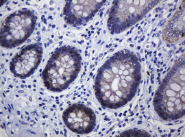 CDH1 / E Cadherin Antibody - IHC of paraffin-embedded Human colon tissue using anti-CDH1 mouse monoclonal antibody.