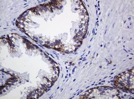 CDH1 / E Cadherin Antibody - IHC of paraffin-embedded Human prostate tissue using anti-CDH1 mouse monoclonal antibody.