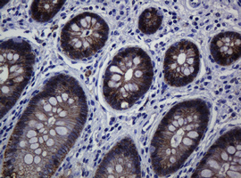 CDH1 / E Cadherin Antibody - IHC of paraffin-embedded Human colon tissue using anti-CDH1 mouse monoclonal antibody.