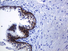 CDH1 / E Cadherin Antibody - IHC of paraffin-embedded Human prostate tissue using anti-CDH1 mouse monoclonal antibody.