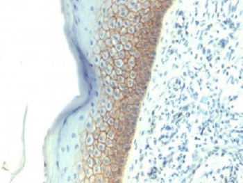 CDH1 / E Cadherin Antibody - IHC testing of FFPE human skin with E-Cadherin antibody (clone SPM381). Required HIER: boil tissue sections in 10mM citrate buffer, pH 6.0, for 10-20 min.