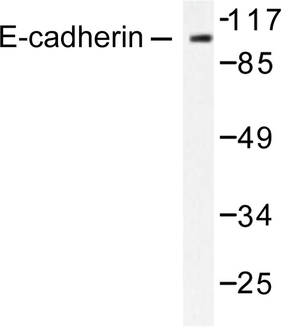 CDH1 / E Cadherin Antibody - Western blot of E-cadherin (G2) pAb in extracts from 293 cells.