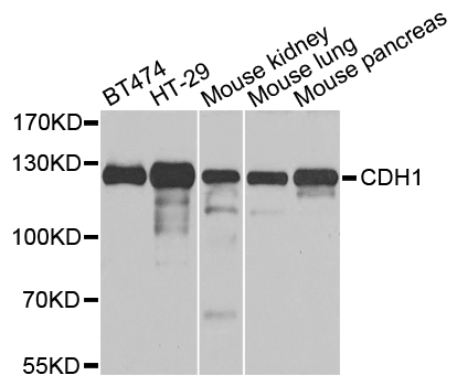 CDH1 / E Cadherin Antibody - Western blot analysis of extracts of various cell lines.
