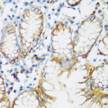 CDH1 / E Cadherin Antibody - Immunohistochemistry of paraffin-embedded human gastric tissue.