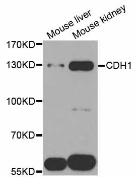 CDH1 / E Cadherin Antibody - Western blot analysis of extracts of various cell lines, using CDH1 antibody at 1:1000 dilution. The secondary antibody used was an HRP Goat Anti-Rabbit IgG (H+L) at 1:10000 dilution. Lysates were loaded 25ug per lane and 3% nonfat dry milk in TBST was used for blocking. An ECL Kit was used for detection and the exposure time was 60s.