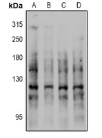 CDH1 / E Cadherin Antibody - Western blot analysis of E Cadherin (pS844) expression in HEK293T (A), HepG2 (B), A549 (C), PC12 (D) whole cell lysates.