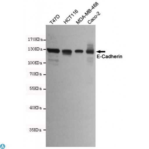 CDH1 / E Cadherin Antibody - Western blot detection of E-Cadherin in T47D, HCT116, MDA-MB-468 and Caco-2 cell lysates using E-Cadherin mouse mAb (dilution 1:2000). Predicted band size: 135kDa. Observed band size: 135kDa.