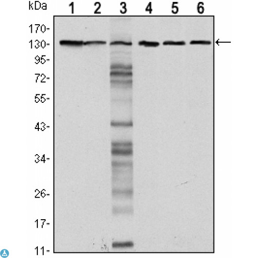 CDH1 / E Cadherin Antibody - Western Blot (WB) analysis using E-cadherin Monoclonal Antibody against LNCAP (1),A431 (2), DU145 (3), PC-3 (4), PC-12 (5) and T47D(6) cell lysate.