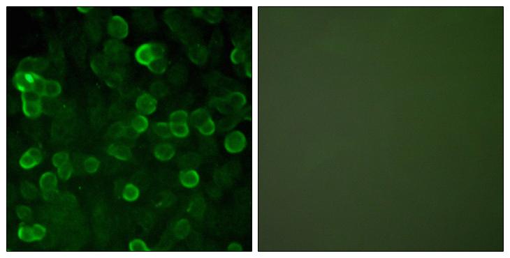 CDH1 / E Cadherin Antibody - Peptide - + Immunofluorescence analysis of A549 cells, using E-cadherin antibody.