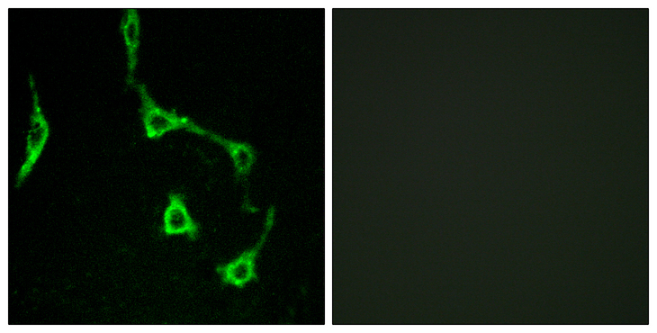 CDH10 / Cadherin 10 Antibody - Immunofluorescence analysis of LOVO cells, using CDH10 Antibody. The picture on the right is blocked with the synthesized peptide.