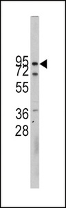 CDH10 / Cadherin 10 Antibody - Western blot of CDH10 Antibody in CEM cell line lysates (35 ug/lane). CDH10 (arrow) was detected using the purified antibody.