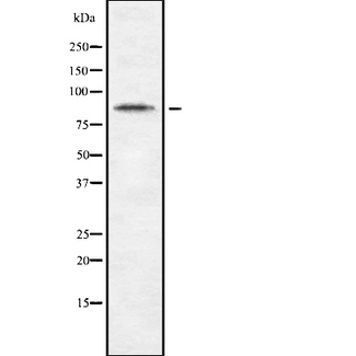 CDH10 / Cadherin 10 Antibody - Western blot analysis of CDH10 using Jurkat whole cells lysates