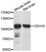 CDH10 / Cadherin 10 Antibody - Western blot analysis of extracts of various cell lines, using CDH10 antibody at 1:1000 dilution. The secondary antibody used was an HRP Goat Anti-Rabbit IgG (H+L) at 1:10000 dilution. Lysates were loaded 25ug per lane and 3% nonfat dry milk in TBST was used for blocking. An ECL Kit was used for detection and the exposure time was 60s.