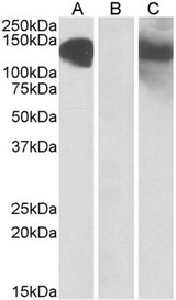 CDH11 / Cadherin 11 Antibody - HEK293 lysate (10ug protein in RIPA buffer) overexpressing Human CDH11 with C-terminal MYC tag probed with (1ug/ml) in Lane A and probed with anti-MYC Tag (1/1000) in lane C. Mock-transfected HEK293 probed (1mg/ml) in Lane B. Primary