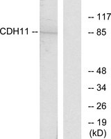 CDH11 / Cadherin 11 Antibody - Western blot analysis of lysates from Jurkat cells, using CDH11 Antibody. The lane on the right is blocked with the synthesized peptide.