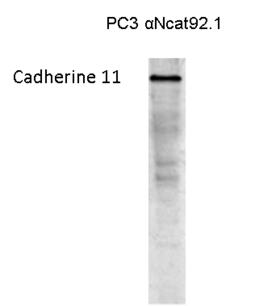 CDH11 / Cadherin 11 Antibody - Western blot on a lysate of Cadherin 11 transfected PC3 cells