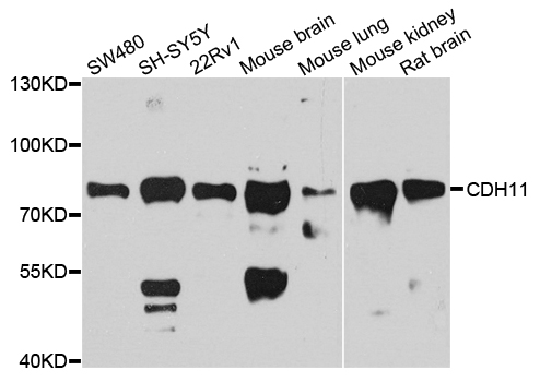CDH11 / Cadherin 11 Antibody - Western blot blot of extract of various cells, using CDH11 antibody.
