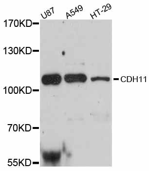 CDH11 / Cadherin 11 Antibody - Western blot analysis of extracts of various cell lines, using CDH11 antibody at 1:3000 dilution. The secondary antibody used was an HRP Goat Anti-Rabbit IgG (H+L) at 1:10000 dilution. Lysates were loaded 25ug per lane and 3% nonfat dry milk in TBST was used for blocking. An ECL Kit was used for detection and the exposure time was 90s.