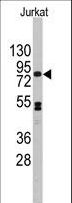 CDH12 / Cadherin 12 Antibody - Western blot of anti-CDH12 Antibody (RB13742) in Jurkat cell line lysates (35 ug/lane). CDH12(arrow) was detected using the purified antibody.